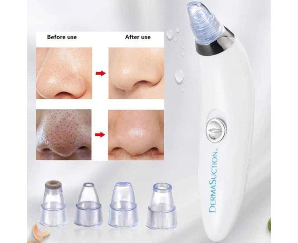 Derma Suction 4 in 1 Blackhead Removal
