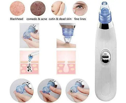 Derma Suction 4 in 1 Blackhead Removal
